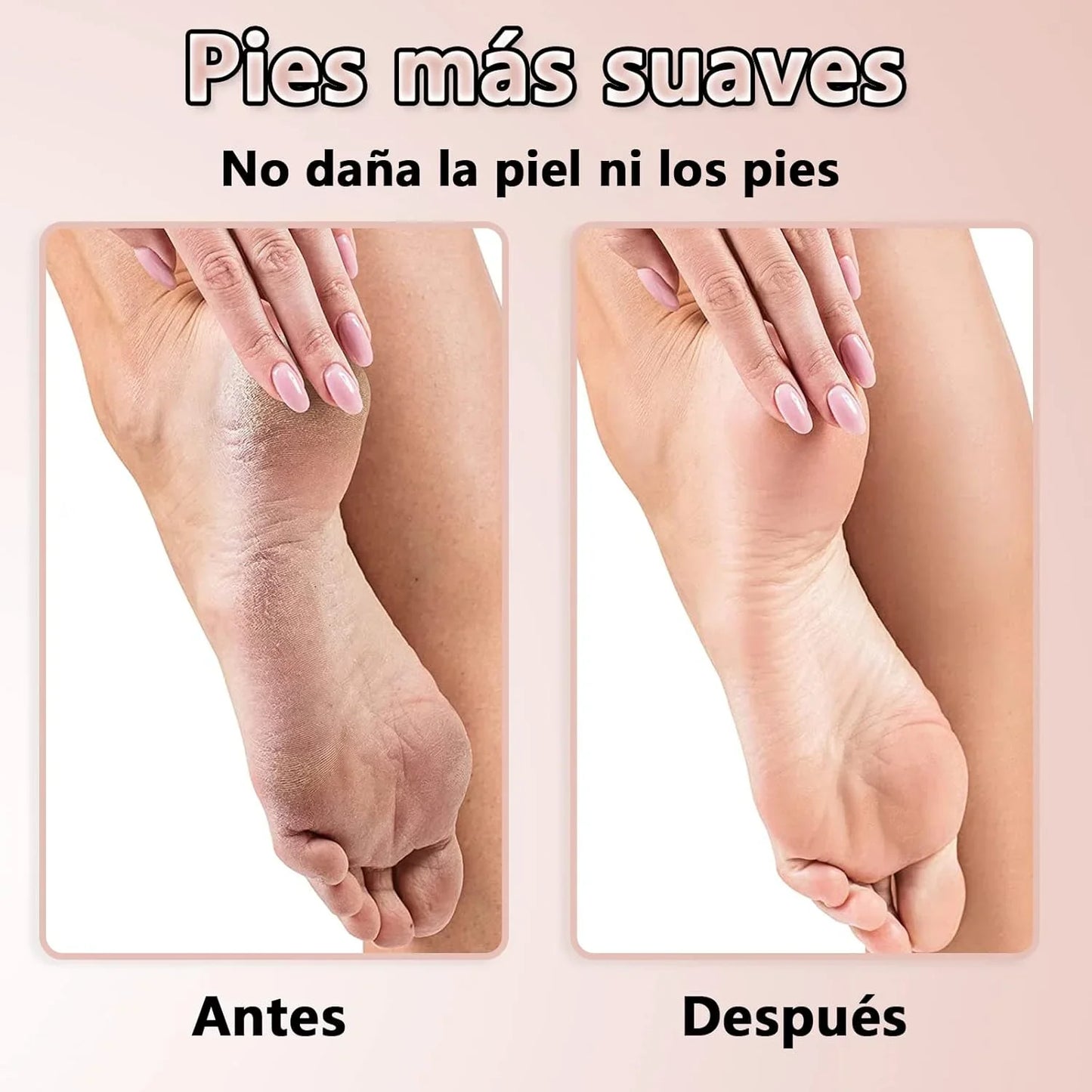 . Electric Pedi - Lima Profesional de Callos Eléctrica - Disfruta pies renovados al instante